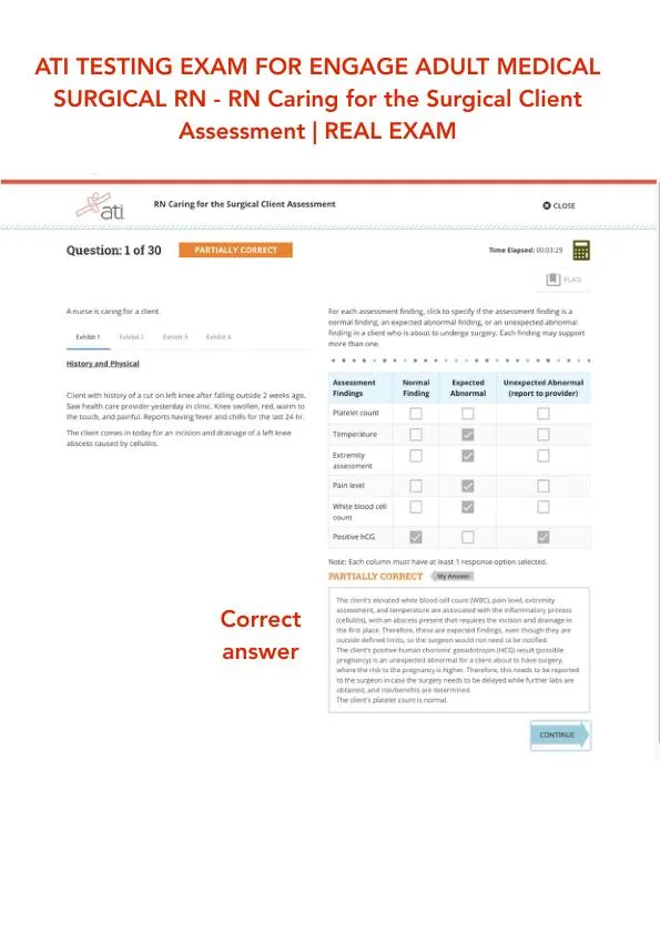 ATI RN Practice Exam with Answers (30 Solved Questions)