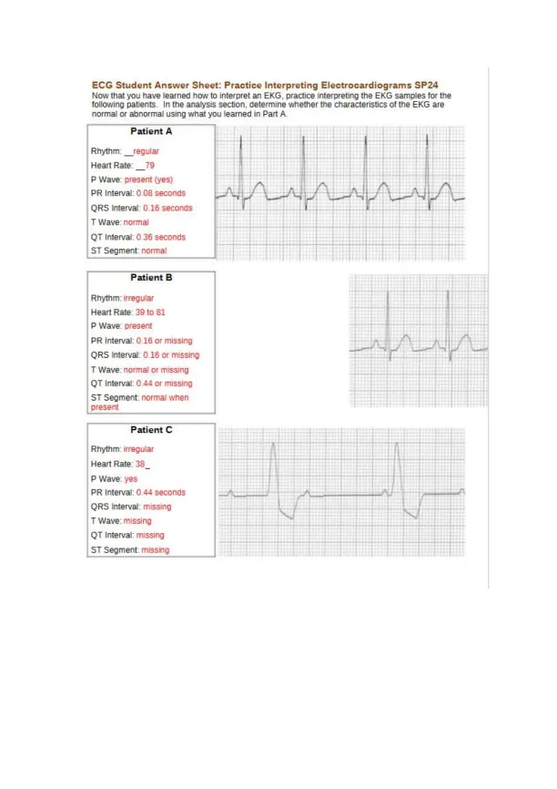 Practice EKG Interpretation ECG Student Answer She - Page 1 preview image