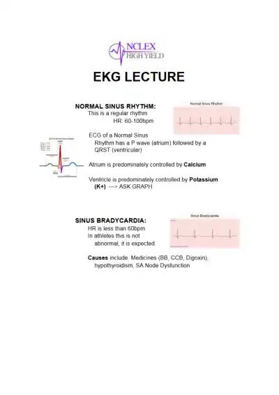 Understanding EKG Rhythms and Pacemaker Care NCLEX - Page 1 preview image