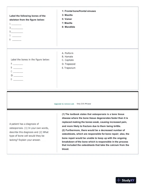 Portage Learning Anatomy and Physiology Final Exam With Answers (142 Solved Questions) - Page 5 preview image